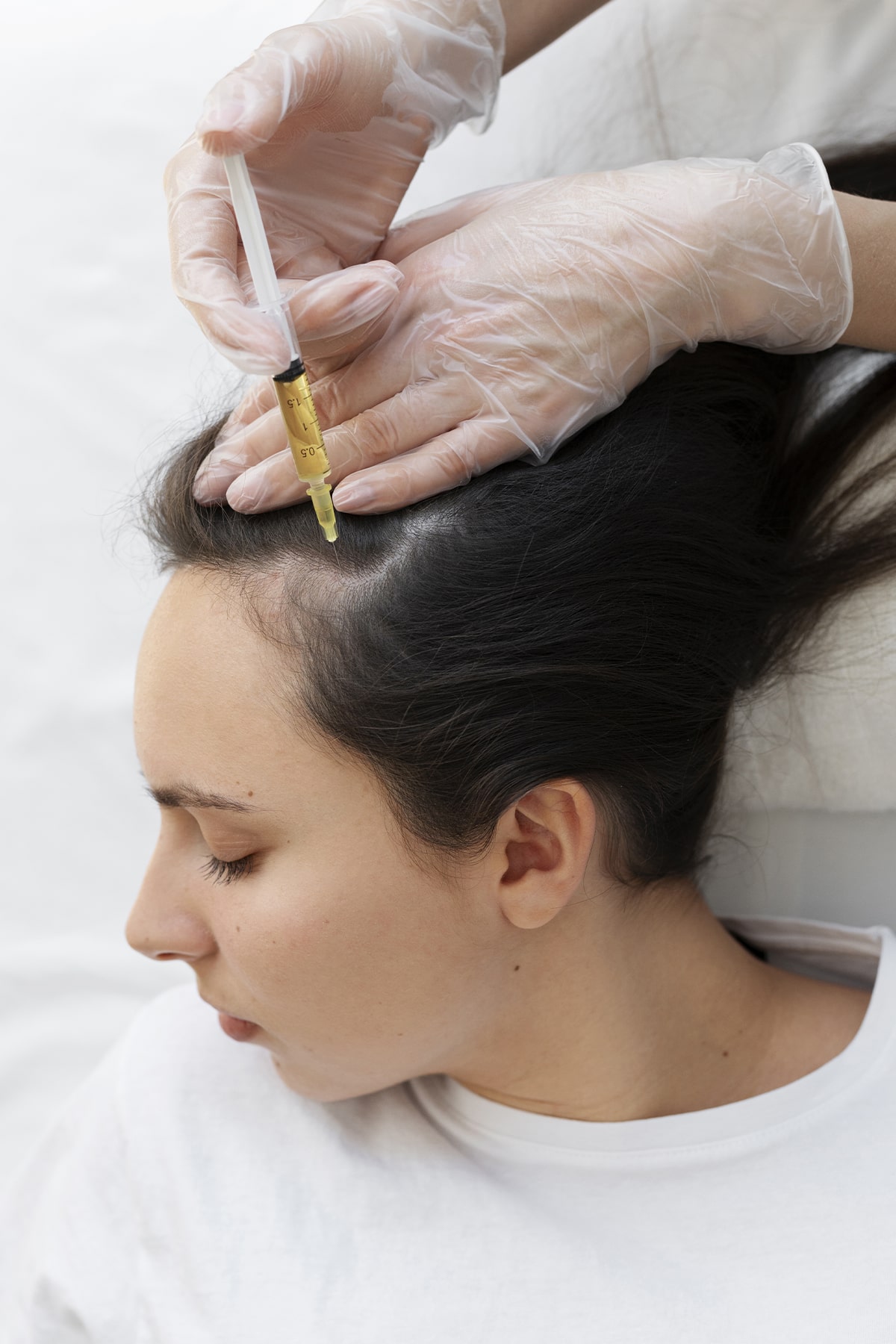 mesotherapy for hair